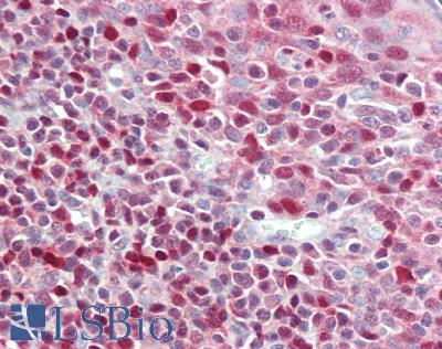 ADK / Adenosine Kinase Antibody - Human Tonsil: Formalin-Fixed, Paraffin-Embedded (FFPE),a t a concentration of 5 ug/ml. 