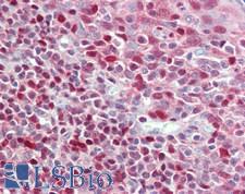ADK / Adenosine Kinase Antibody - Human Tonsil: Formalin-Fixed, Paraffin-Embedded (FFPE),a t a concentration of 5 ug/ml. 