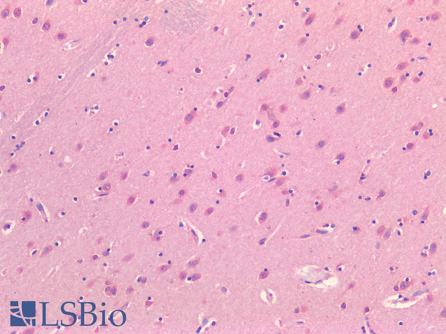 ADORA2A/Adenosine A2A Receptor Antibody - Human Brain, Basal Ganglia: Formalin-Fixed, Paraffin-Embedded (FFPE)