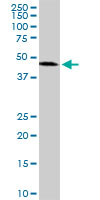 ADPRH / ARH1 Antibody - ADPRH monoclonal antibody (M04), clone 1F11. Western blot of ADPRH expression in K-562.