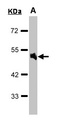 ADRA1A Antibody - Sample(30 g of whole cell lysate). A: Raji. 10% SDS PAGE. ADRA1A antibody diluted at 1:1000.