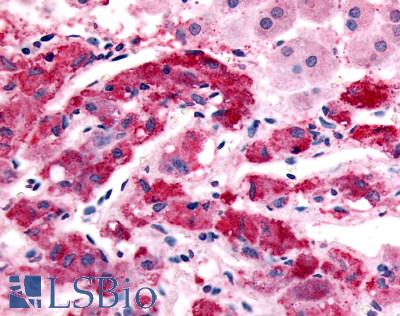 ADRA1B / Adrenoceptor alpha 1B Antibody - Anti-ADRA1B antibody IHC of human adrenal, medulla. Immunohistochemistry of formalin-fixed, paraffin-embedded tissue after heat-induced antigen retrieval.