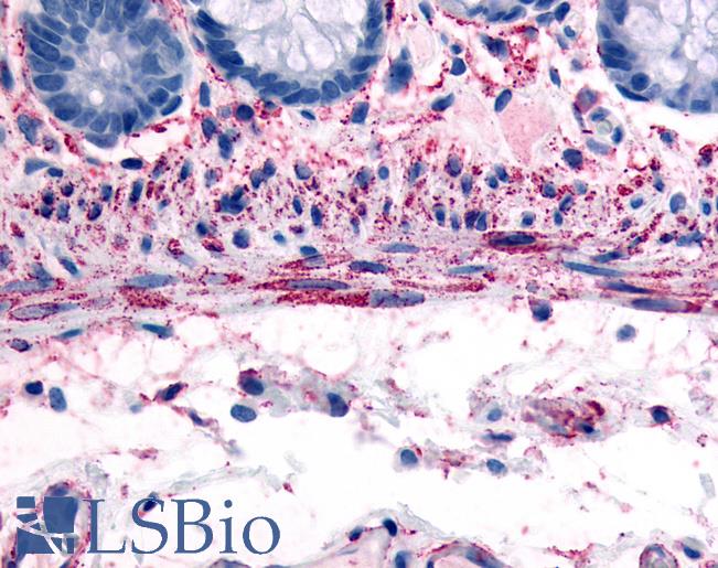 ADRA1B / Adrenoceptor alpha 1B Antibody - Anti-ADRA1B antibody IHC of human smooth muscle cells. Immunohistochemistry of formalin-fixed, paraffin-embedded tissue after heat-induced antigen retrieval.