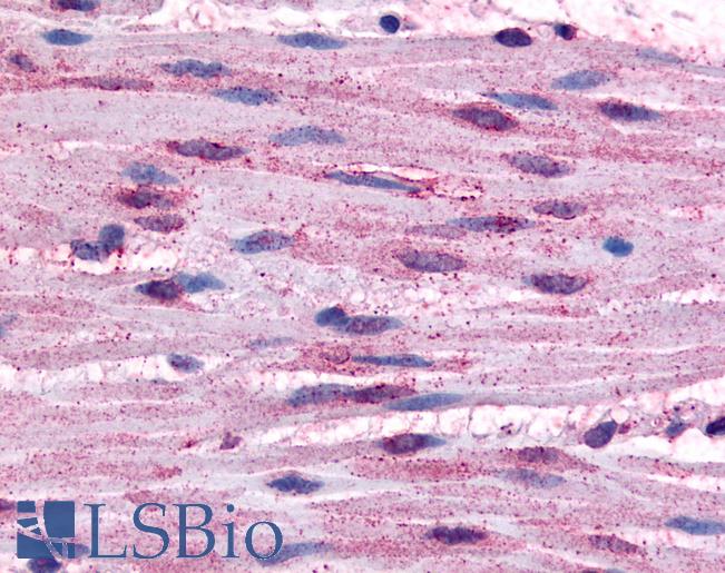 ADRA1B / Adrenoceptor alpha 1B Antibody - Anti-ADRA1B antibody IHC of human smooth muscle cells. Immunohistochemistry of formalin-fixed, paraffin-embedded tissue after heat-induced antigen retrieval.