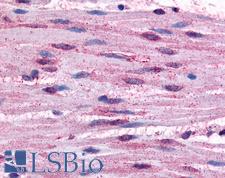 ADRA1B / Adrenoceptor alpha 1B Antibody - Anti-ADRA1B antibody IHC of human smooth muscle cells. Immunohistochemistry of formalin-fixed, paraffin-embedded tissue after heat-induced antigen retrieval.