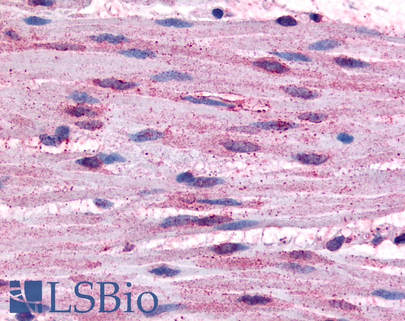 ADRA1B / Adrenoceptor alpha 1B Antibody - Anti-ADRA1B antibody IHC of human smooth muscle cells. Immunohistochemistry of formalin-fixed, paraffin-embedded tissue after heat-induced antigen retrieval.