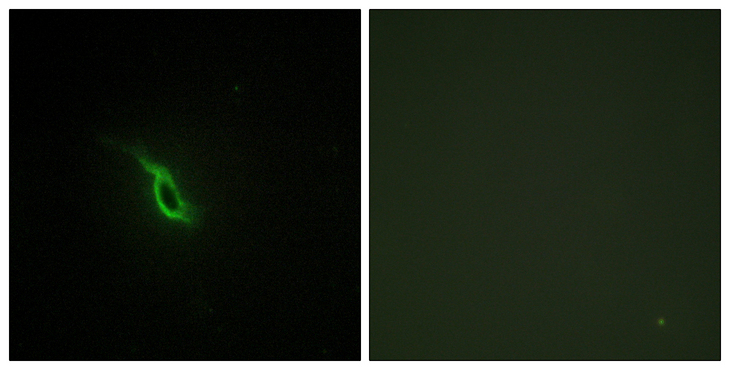 ADRA2A Antibody - Immunofluorescence analysis of NIH/3T3 cells, using Adrenergic Receptor alpha-2A Antibody. The picture on the right is blocked with the synthesized peptide.
