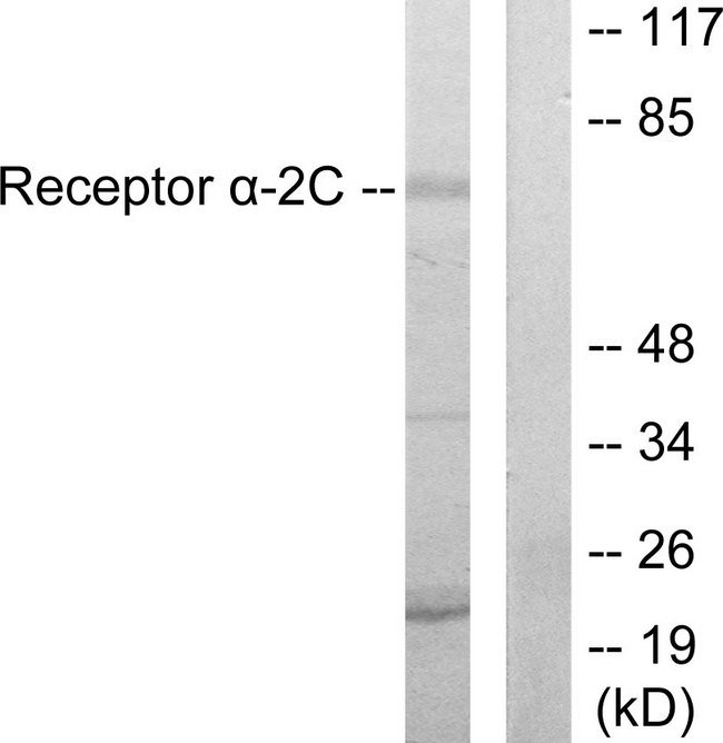 ADRA2C Antibody - Western blot analysis of lysates from HepG2 cells, using Adrenergic Receptor alpha-2C Antibody. The lane on the right is blocked with the synthesized peptide.