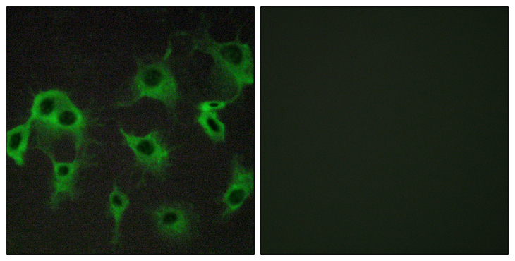 ADRB2 Antibody - Immunofluorescence analysis of COS7 cells, using ADRB2 Antibody. The picture on the right is blocked with the synthesized peptide.