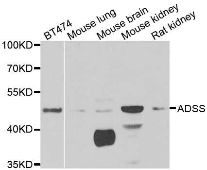 ADSS Antibody - Western blot analysis of extracts of various cell lines, using ADSS antibody.
