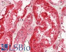 ADSS Antibody - Human Kidney: Formalin-Fixed, Paraffin-Embedded (FFPE)