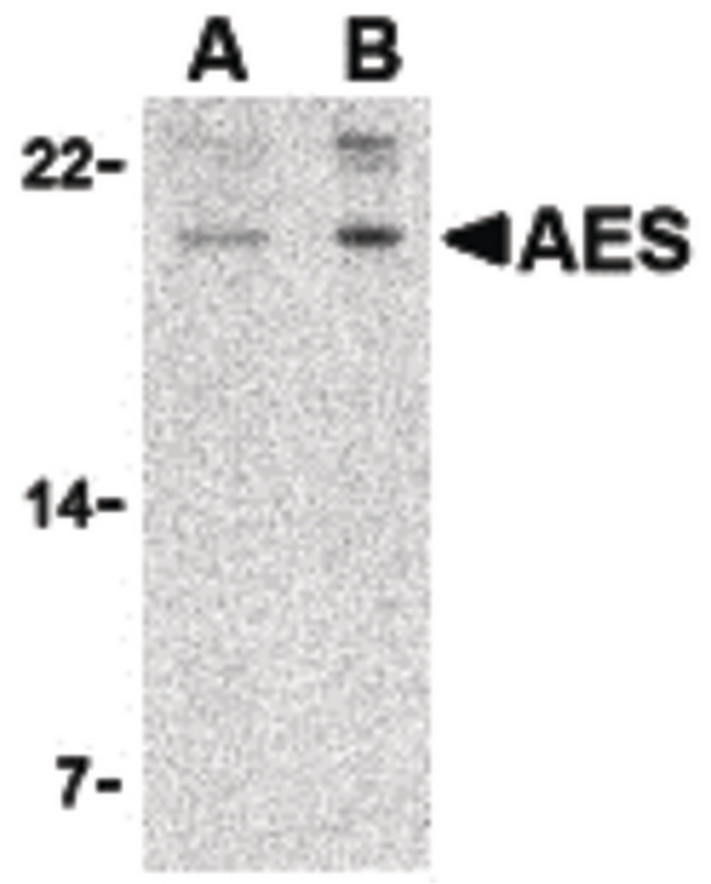 AES / Groucho Antibody - Western blot of AES in 293 cell lysate with AES antibody at (A) 2 and (B) 4 ug/ml.
