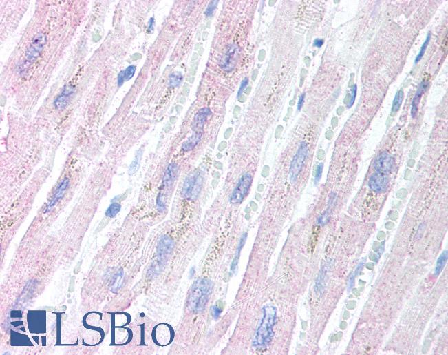 AES / Groucho Antibody - Anti-AES antibody IHC of human heart. Immunohistochemistry of formalin-fixed, paraffin-embedded tissue after heat-induced antigen retrieval. Antibody concentration 5 ug/ml.