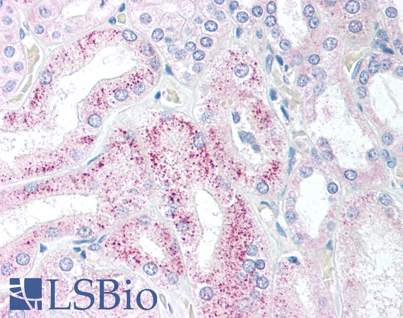 AES / Groucho Antibody - Anti-AES antibody IHC of human kidney. Immunohistochemistry of formalin-fixed, paraffin-embedded tissue after heat-induced antigen retrieval. Antibody concentration 5 ug/ml.