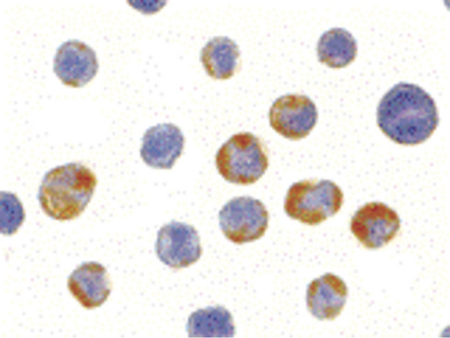 AES / Groucho Antibody - Immunocytochemistry of AES in HeLa cells with AES antibody at 10 ug/ml.