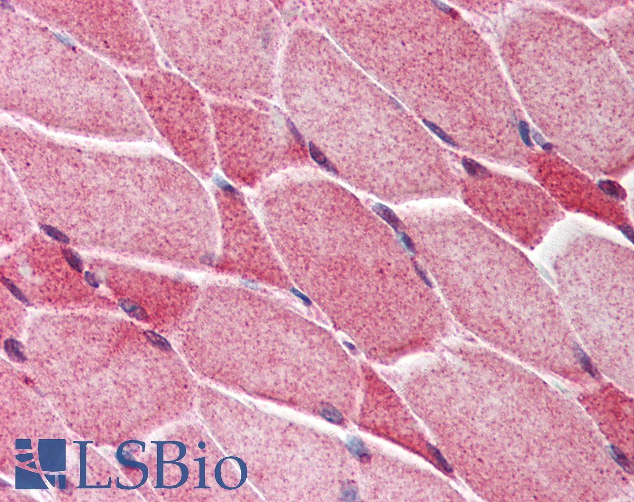 AES / Groucho Antibody - Anti-AES antibody IHC of human skeletal muscle. Immunohistochemistry of formalin-fixed, paraffin-embedded tissue after heat-induced antigen retrieval. Antibody concentration 5 ug/ml.
