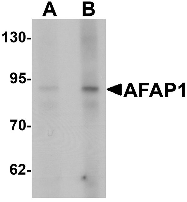 AFAP1 / AFAP Antibody - Western blot analysis of AFAP1 in HeLa cell lysate with AFAP1 antibody at (A) 1 and (B) 2 ug/ml.