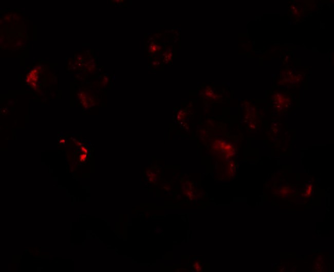 AFAP1L1 Antibody - Immunofluorescence of AFAP1L in A549 cells with AFAP1L antibody at 20 µg/mL.