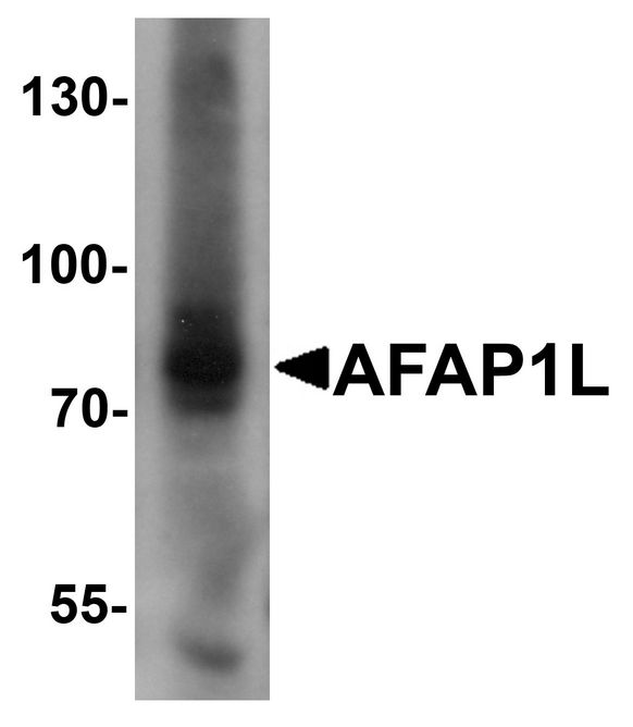 AFAP1L1 Antibody - Western blot analysis of AFAP1L1 in A549 cell lysate with AFAP1L1 antibody at 1 ug/ml.