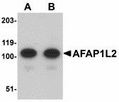 AFAP1L2 / XB130 Antibody - Western blot of AFAP1L2 in mouse liver tissue lysate with AFAP1L2 antibody at (A) 1 and (B) 2 ug/ml. 