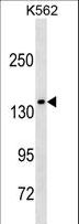 AFF1 / AF4 Antibody - MLLT2 Antibody (C-term T1196) western blot of K562 cell line lysates (35 ug/lane). The MLLT2 antibody detected the MLLT2 protein (arrow).