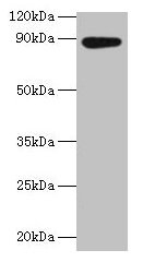 AFG3L2 Antibody - Western blot All lanes: AFG3-like protein 2 antibody at 2µg/ml + EC109 whole cell lysate Secondary Goat polyclonal to rabbit IgG at 1/15000 dilution Predicted band size: 87.7 kDa Observed band size: 87.7 kDa