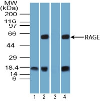 AGER / RAGE Antibody - Western blot of RAGE in 1) human lung tissue lysate, mouse lung tissue lysate in the 2) absence and 3) presence of immunizing peptide, and 4) rat lung tissue lysate using AGER / RAGE Antibody at 3, 0.1 and 0.1 ug/ml, respectively. Goat anti-rabbit Ig HRP secondary antibody, and PicoTect ECL substrate solution were used for this test. Note: This antibody was raised against an amino acid sequence that is 100% conserved in human, however western blot testing shows that it does not detected the expected ~45 kD band in human lung lysate.