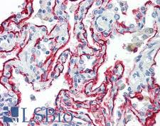AGER / RAGE Antibody - Anti-AGER / RAGE antibody IHC of human lung. Immunohistochemistry of formalin-fixed, paraffin-embedded tissue after heat-induced antigen retrieval. Antibody dilution 10 ug/ml.