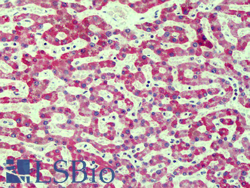 AGER / RAGE Antibody - Anti-RAGE antibody IHC of human liver. Immunohistochemistry of formalin-fixed, paraffin-embedded tissue after heat-induced antigen retrieval. Antibody concentration 10 ug/ml. This image was taken for the unconjugated form of this product. Other forms have not been tested.