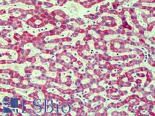 AGER / RAGE Antibody - Anti-RAGE antibody IHC of human liver. Immunohistochemistry of formalin-fixed, paraffin-embedded tissue after heat-induced antigen retrieval. Antibody concentration 10 ug/ml. This image was taken for the unconjugated form of this product. Other forms have not been tested.