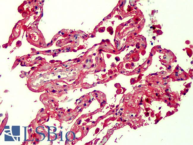 AGER / RAGE Antibody - Anti-RAGE antibody IHC of human lung. Immunohistochemistry of formalin-fixed, paraffin-embedded tissue after heat-induced antigen retrieval. Antibody concentration 10 ug/ml. This image was taken for the unconjugated form of this product. Other forms have not been tested.