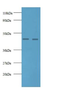 AGER / RAGE Antibody - Western blot of Advanced glycosylation end product-specific receptor antibody at 2 ug/ml. Lane 1: EC109 whole cell lysate. Lane 2: 293T whole cell lysate. Secondary: Goat polyclonal to rabbit IgG at 1:10000 dilution. Predicted band size: 44 kDa. Observed band size: 44 kDa.  This image was taken for the unconjugated form of this product. Other forms have not been tested.