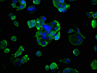 AGER / RAGE Antibody - Immunofluorescence staining of MCF-7 cells with AGER Antibody at 1:200, counter-stained with DAPI. The cells were fixed in 4% formaldehyde, permeabilized using 0.2% Triton X-100 and blocked in 10% normal Goat Serum. The cells were then incubated with the antibody overnight at 4°C. The secondary antibody was Alexa Fluor 488-congugated AffiniPure Goat Anti-Rabbit IgG(H+L).