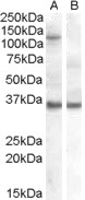 AGO1 / EIF2C Antibody - HEK293 overexpressing EIF2C1 and probed with (non-transfected HEK293 in lane B).