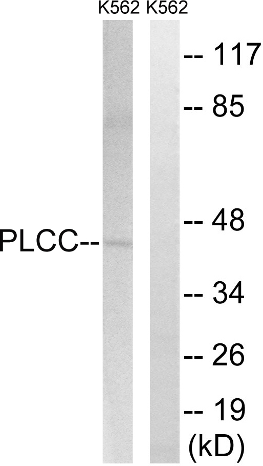 AGPAT3 Antibody - Western blot analysis of lysates from K562 cells, using AGPAT3 Antibody. The lane on the right is blocked with the synthesized peptide.