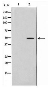 AGPAT9 / MAG1 Antibody - Western blot of Jurkat cell lysate using PLCH Antibody