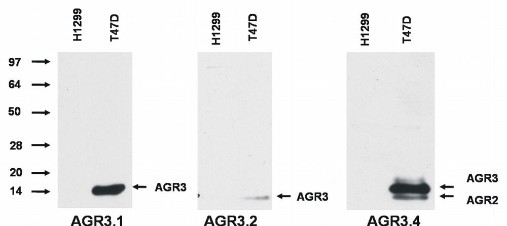AGR2/AGR3 Antibody - Western blotting analysis of AGR3 protein by AGR3.1 and AGR3.2 antibody, and of AGR3 and AGR2 protein by AGR3.4 antibody in T47D breast cancer cell line compared to H1229 lung carcinoma cell line.