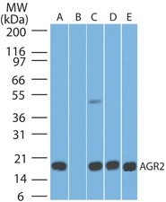 AGR2 Antibody - Western blot analysis of Anti-AGR2 antibody (LS-B8672, 5 µg/ml).  Lane A: Human stomach tissue lysate in the absence of immunizing peptide. Lane B: human stomach tissue lysate in the presence of immunizing peptide. Lane C: Mouse stomach tissue lysate. Lane D. Rat stomach tissue lysate, and Lane E: HCT-116 cell lysate. Antibody produced band at ~20 kDa except when in the presence of immunizing peptide.