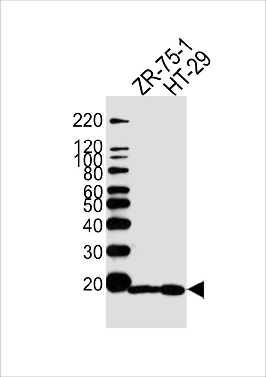 AGR2 Antibody - Western blot of lysates from ZR-75-1, HT29 cell line (from left to right), using AGR2 Antibody. Antibody was diluted at 1:1000 at each lane. A goat anti-rabbit IgG H&L (HRP) at 1:5000 dilution was used as the secondary antibody. Lysates at 35ug per lane.