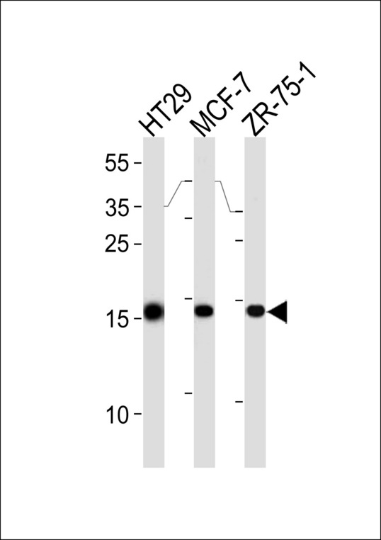 AGR2 Antibody - AGR2 Antibody western blot of HT29,MCF-7,ZR-75-1 cell line lysates (35 ug/lane). The AGR2 antibody detected the AGR2 protein (arrow).