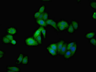 AGT / Angiotensinogen Antibody - Immunofluorescent analysis of HepG2 cells using Rabbit anti-human Angiotensinogen polyclonal Antibody(AGT) at dilution of 1:100 and Alexa Fluor 488-congugated AffiniPure Goat Anti-Rabbit IgG(H+L)