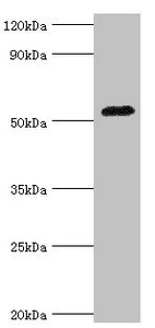 AGT / Angiotensinogen Antibody - Western blot All lanes: Angiotensinogen antibody at 3µg/ml + Mouse liver tissue Secondary Goat polyclonal to rabbit IgG at 1/10000 dilution Predicted band size: 53 kDa Observed band size: 53 kDa