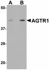 AGTR1 / AT1 Receptor Antibody - Western blot of AGTR1 in mouse kidney tissue lysate with AGTR1 antibody at (A) 1 and (B) 2 ug/ml.
