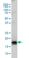 AGTRAP / ATRAP Antibody - AGTRAP monoclonal antibody (M02), clone 1G2 Western blot of AGTRAP expression in HeLa NE.