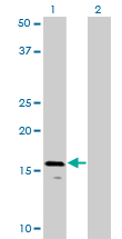 AGTRAP / ATRAP Antibody - Western blot of AGTRAP expression in transfected 293T cell line by AGTRAP monoclonal antibody (M02), clone 1G2.