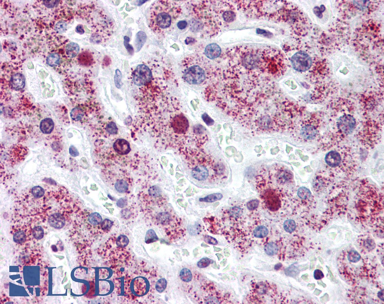 AGXT / SPT Antibody - Anti-AGXT antibody IHC of human liver. Immunohistochemistry of formalin-fixed, paraffin-embedded tissue after heat-induced antigen retrieval. Antibody concentration 5 ug/ml.