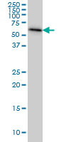 AHCYL1 / DCAL Antibody - AHCYL1 monoclonal antibody (M05), clone 5D6 Western blot of AHCYL1 expression in HeLa.