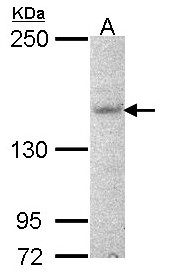 AHI1 Antibody - Sample (30 ug of whole cell lysate). A: NT2D1. 5% SDS PAGE. AHI1 antibody diluted at 1:1000.