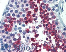 AHI1 Antibody - Human Testis: Formalin-Fixed, Paraffin-Embedded (FFPE)