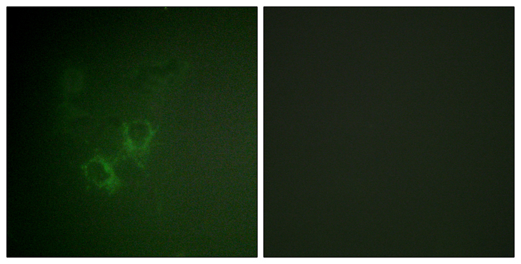 AHR Antibody - Immunofluorescence analysis of HeLa cells, using AhR Antibody. The picture on the right is blocked with the synthesized peptide.